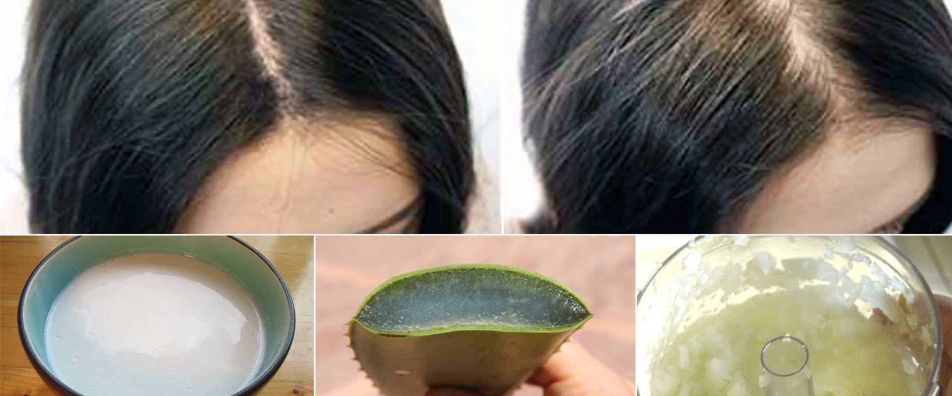 Natural Remedies for Female Hair Loss