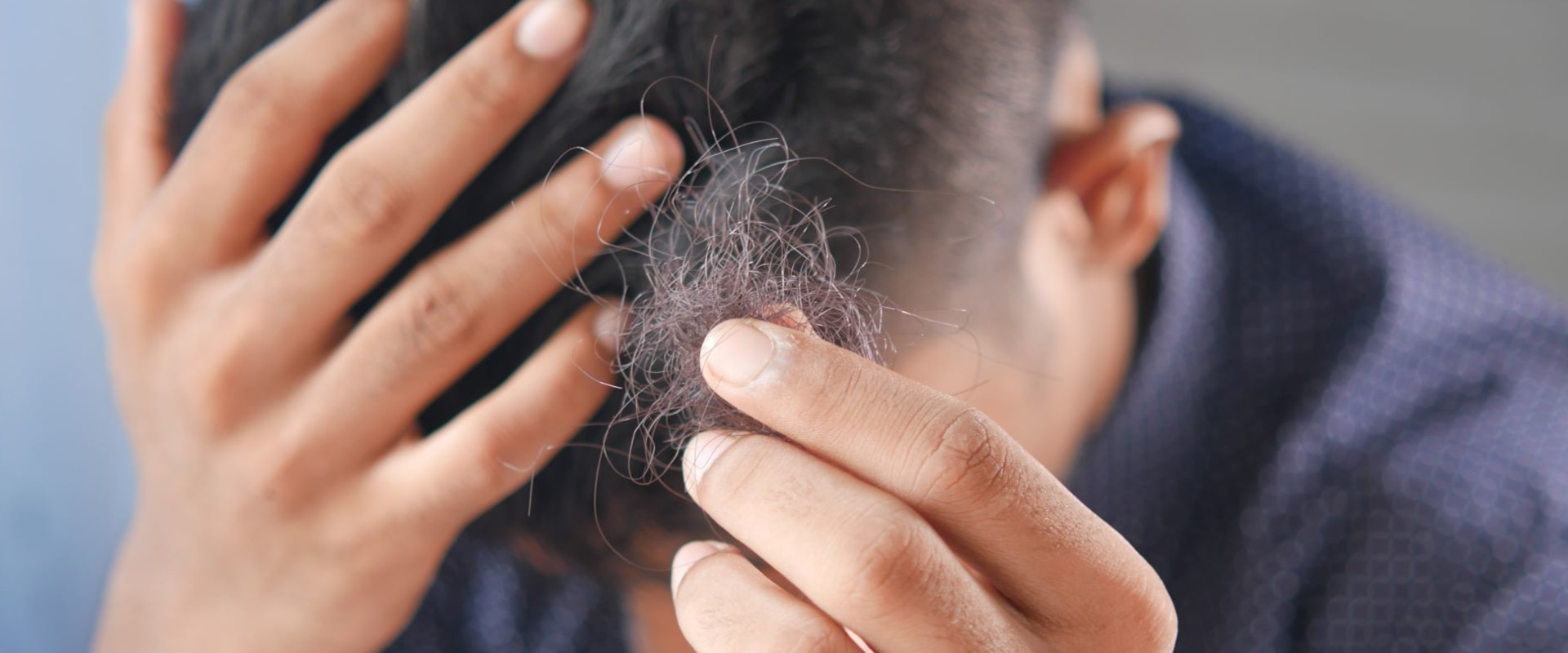 The Link Between Stress and Hair Loss