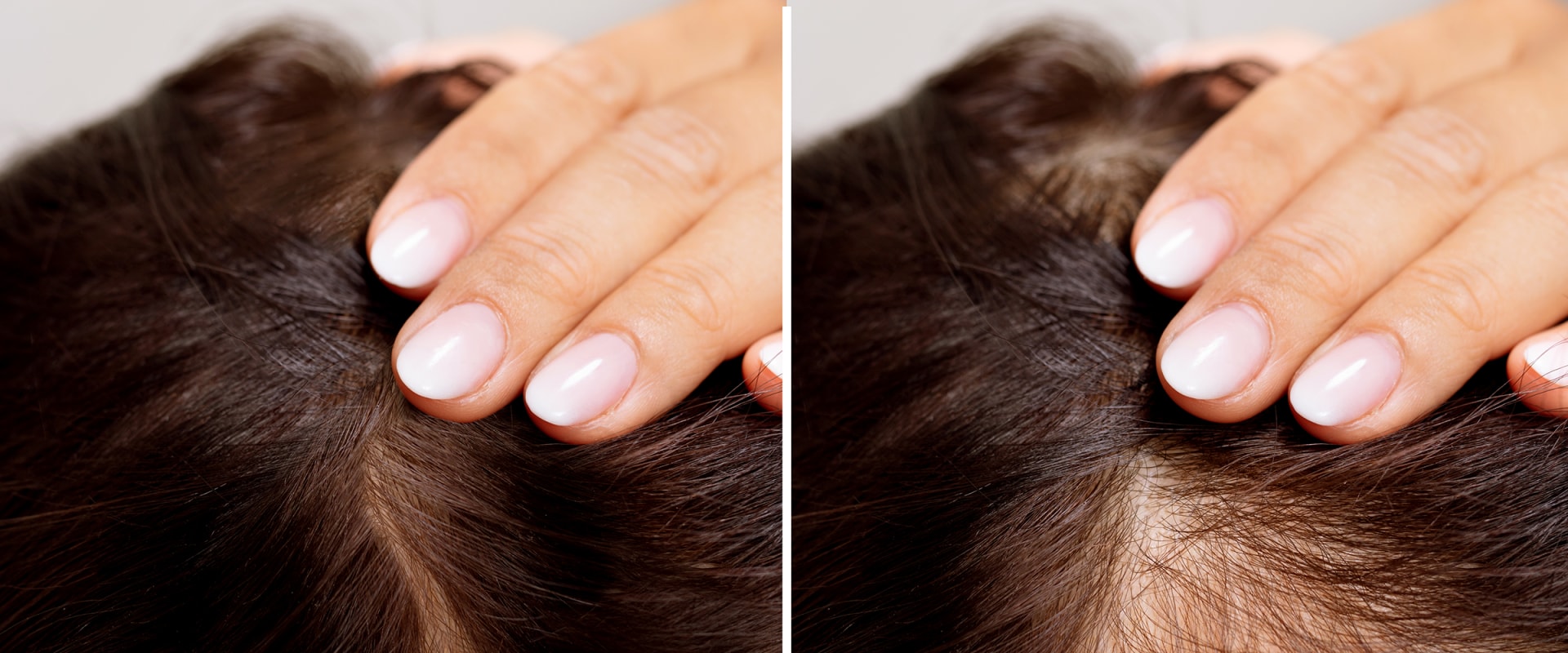 Medical Conditions and Female Hair Loss