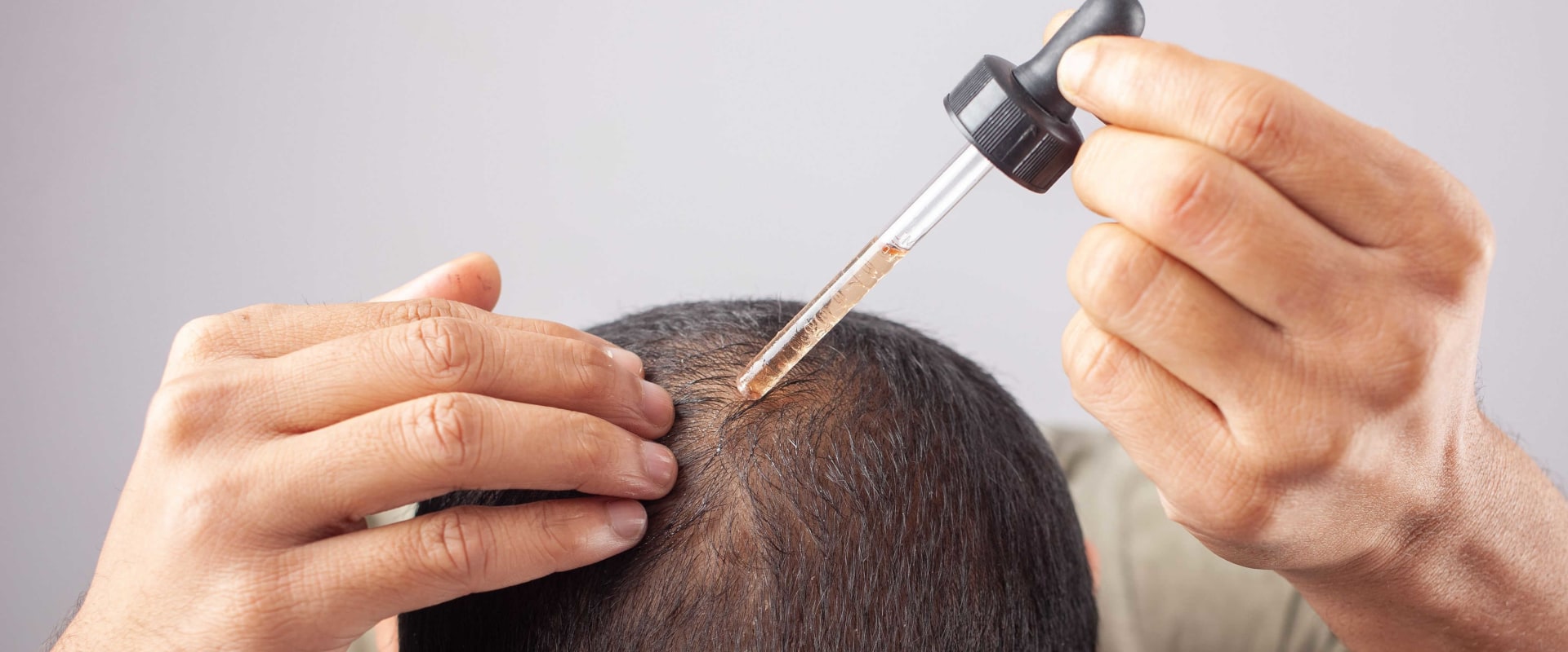 Everything You Need to Know About Minoxidil