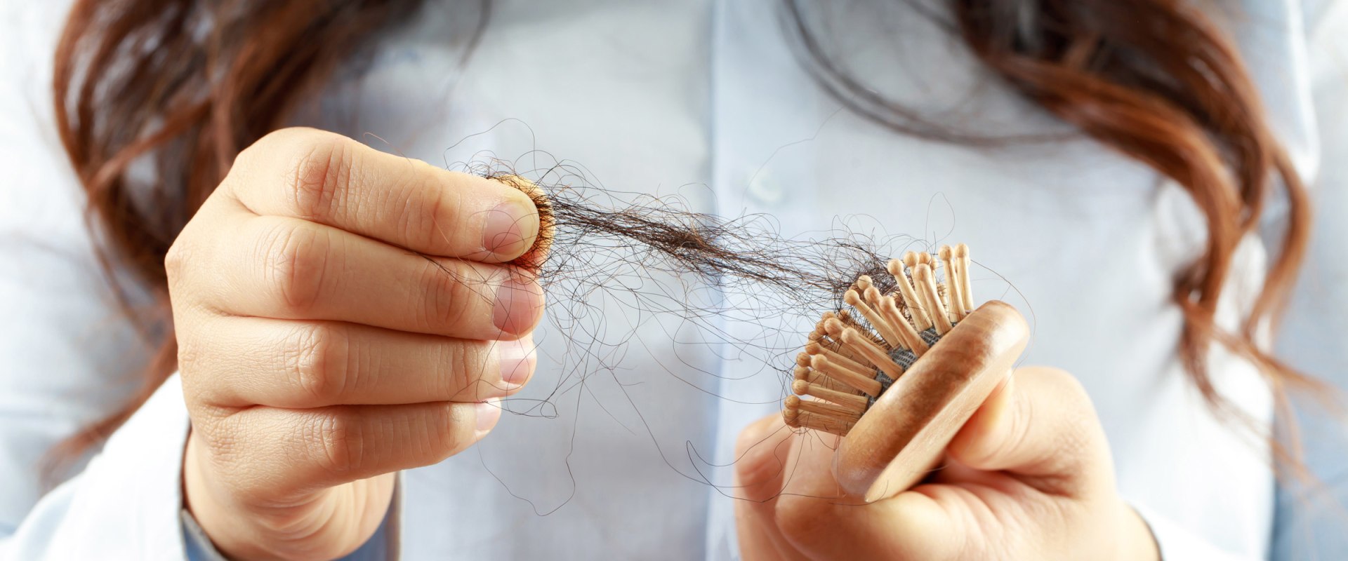 Finasteride: An Overview of Hair Loss Treatment