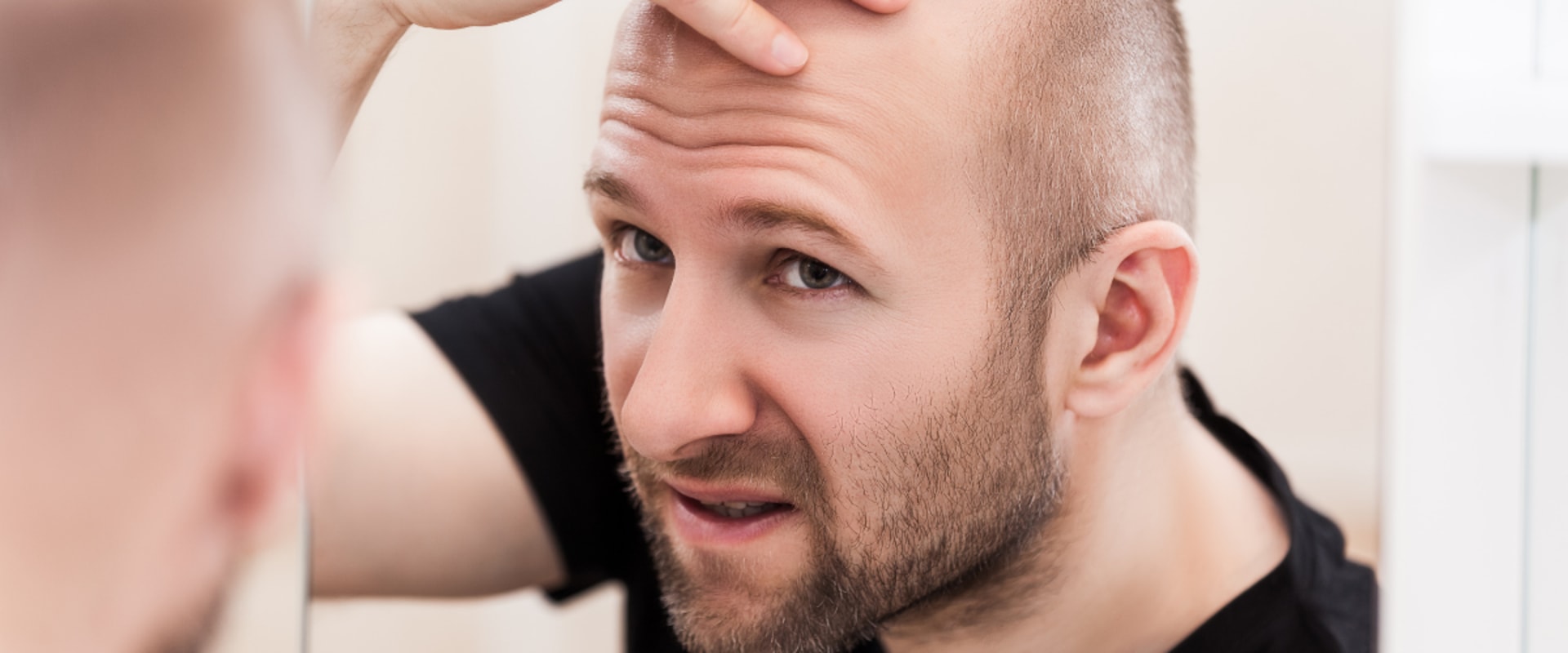Genetics and Male Pattern Baldness: Causes and Risk Factors Explained