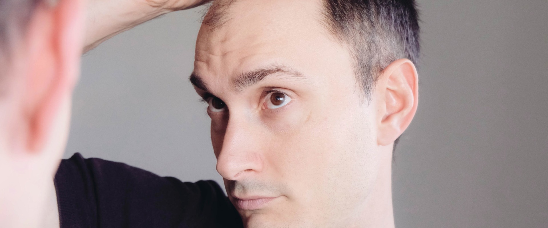 Lifestyle Changes to Prevent Male Pattern Baldness