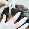 Scalp Treatments for Hair Growth: Tips and Techniques