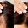 Medical Conditions and Female Hair Loss