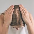Diagnosing Female Hair Loss: What You Need to Know