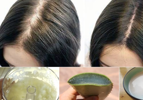 Natural Remedies for Female Hair Loss