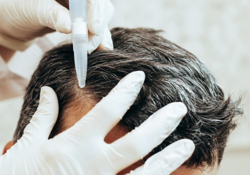 Scalp Treatments for Hair Growth: Tips and Techniques