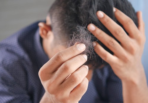 The Link Between Stress and Hair Loss