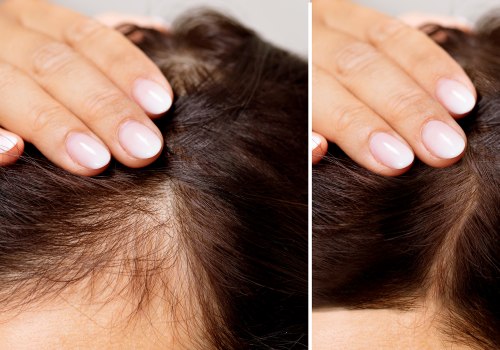 Medical Conditions and Female Hair Loss