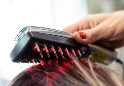 Low-Level Laser Therapy (LLLT): A Hair Loss Treatment and Solution