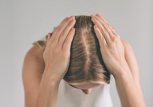 Diagnosing Female Hair Loss: What You Need to Know